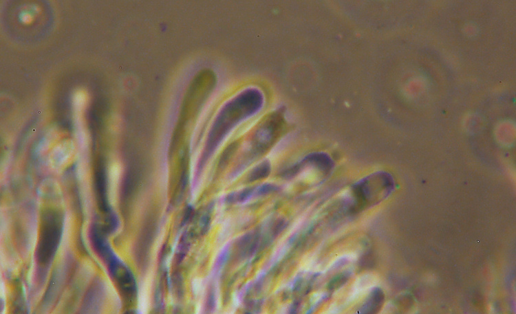 Hyphodontia?